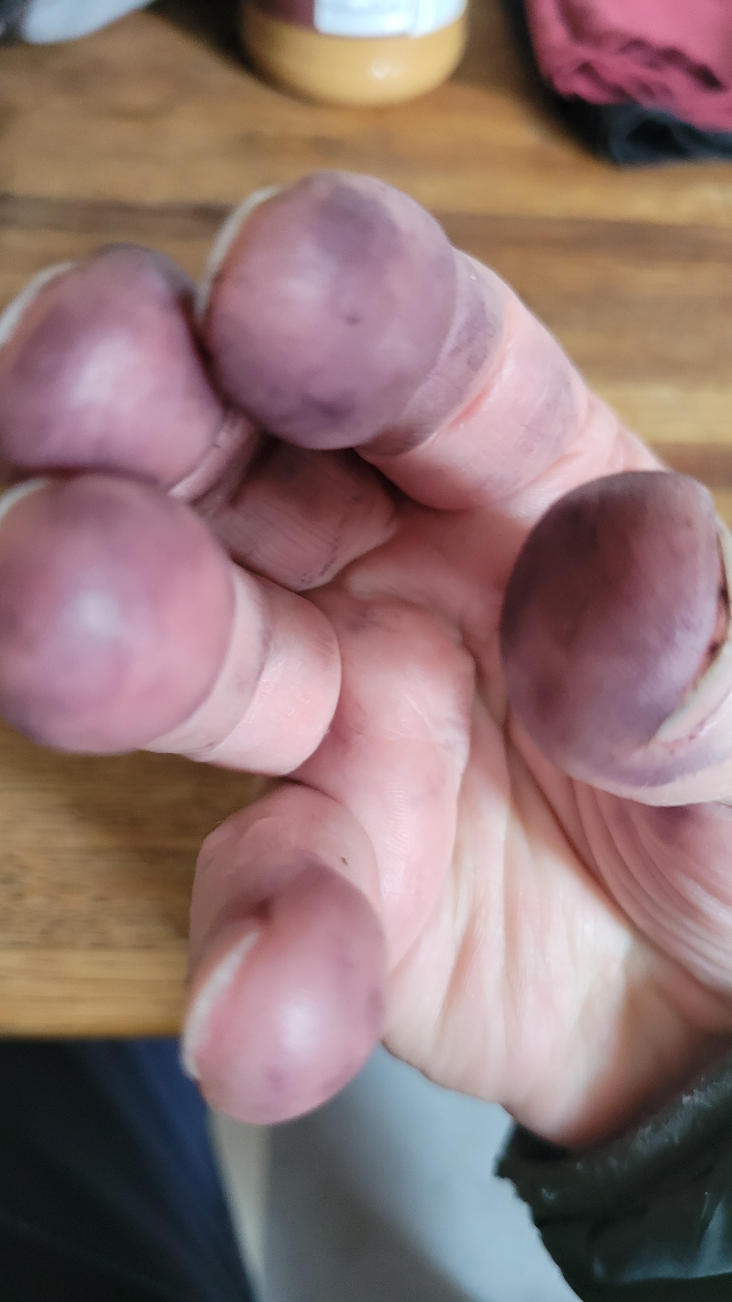 Will's Hand